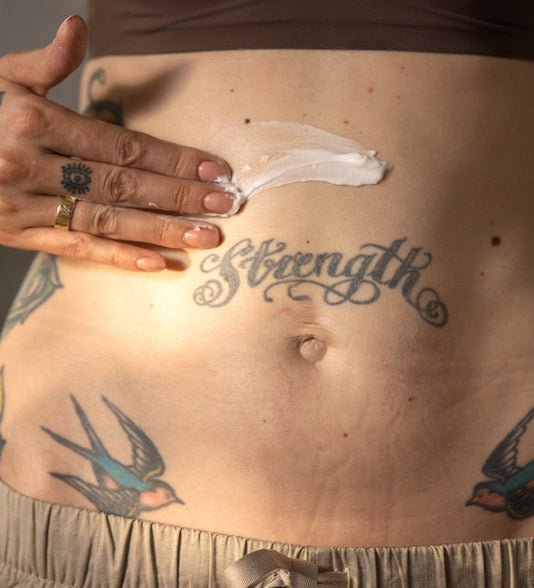 Everything You Need to Know About Stretch Marks - Matrescence