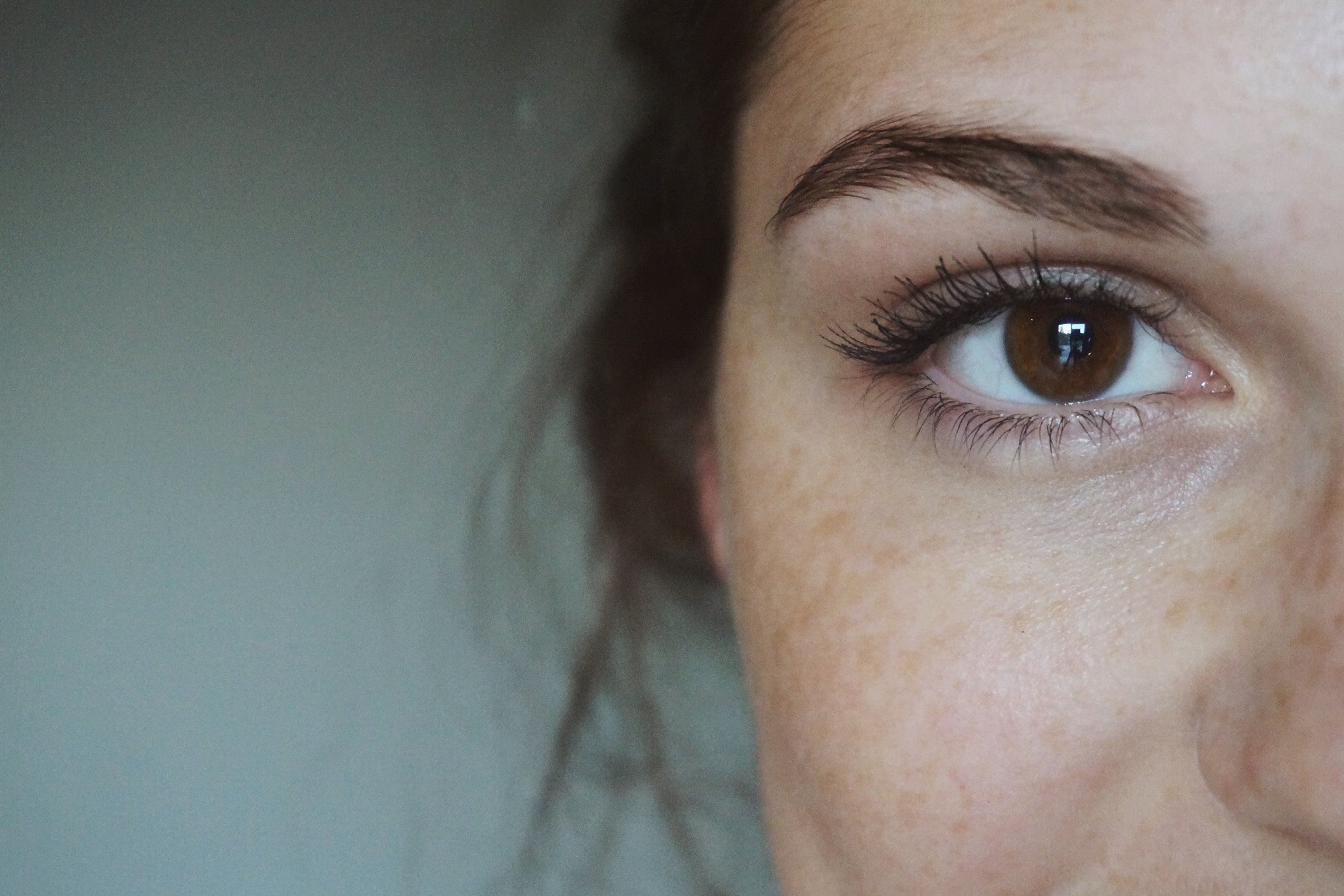 Pregnancy Skincare: Everything You Need To Know About Melasma