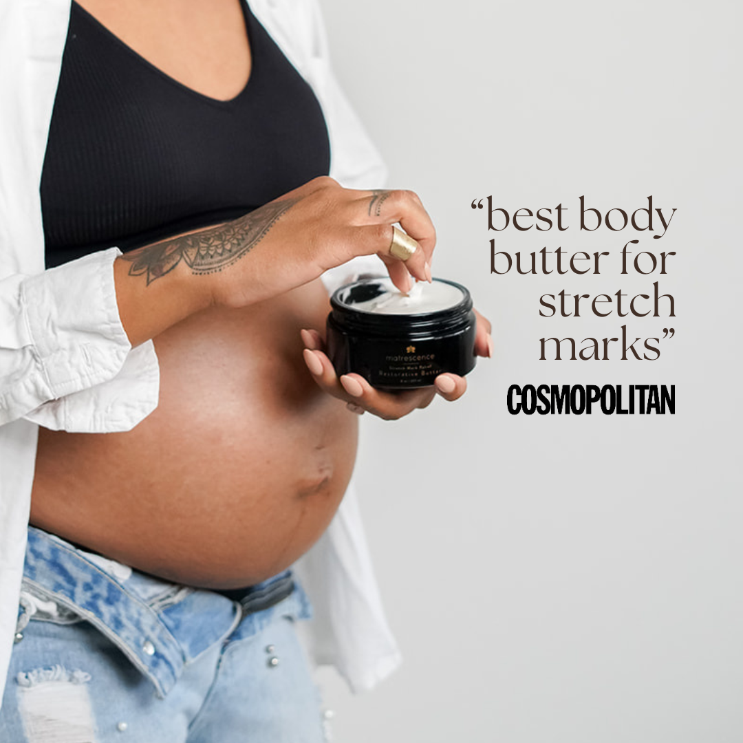 The Stretch Mark Relief Trio
