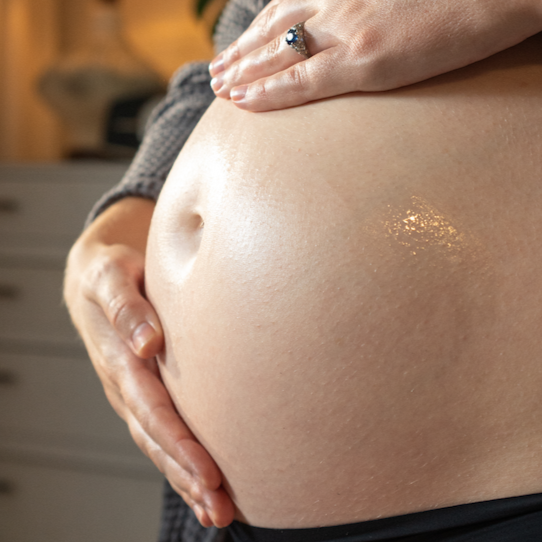 The Stretch Mark Relief Trio
